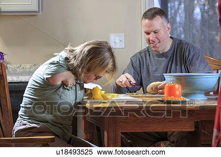 Woman with TAR Syndrome cutting vegetables View Large Photo Image Stock Photography - Woman with TAR Syndrome cutting vegetables. Fotosearch