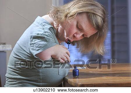 Stock Image - Woman with TAR Syndrome painting her nails. Fotosearch