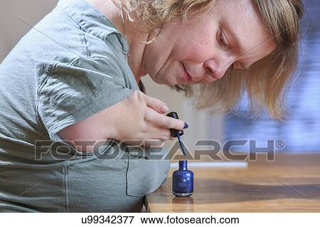 Woman with TAR Syndrome painting her nails View Large Photo Image Stock Photo - Woman with TAR Syndrome painting her nails. Fotosearch