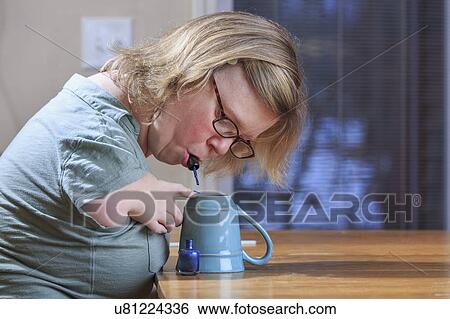 Woman with TAR Syndrome painting her nails View Large Photo Image Stock Photograph - Woman with TAR Syndrome painting her nails. Fotosearch