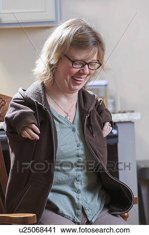 Stock Image - Woman with TAR Syndrome. Fotosearch