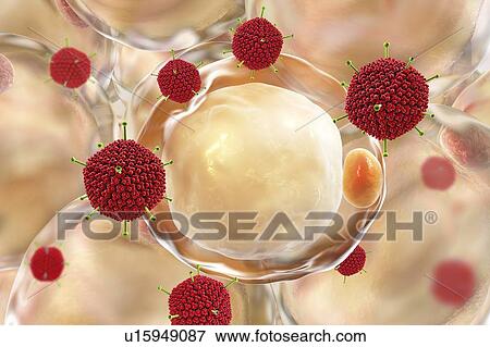 Stock Photo - Adenovirus AD-36 and fat cells. Computer illustration of adenovirus AD-36 particles and fat cells (adipocytes). AD-36 is one of 51 types of adenoviruses known to infect humans. Most adenoviruses result in cold, gastroenteritis, inflammation or fever..... Fotosearch