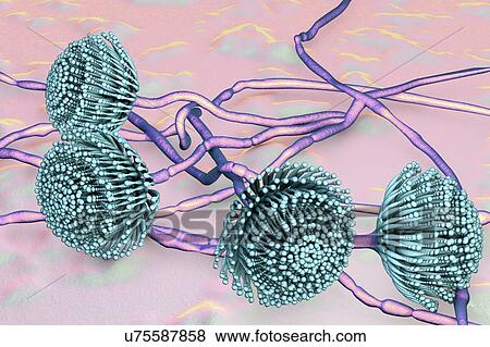 Stock Photo - Aspergillus fungus, computer illustration. This is a toxic fungus that causes diseases in humans. These include fungal ear, lung and skin infections (lobomycosis, pulmonary aspergillosis, and mycotic keratitis). It also produces aflatoxin, one of the.... Fotosearch