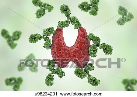 Stock Image - Autoimmune thyroiditis (Hashimoto's disease), conceptual illustration. Antibodies are attacking the thyroid gland.. Fotosearch