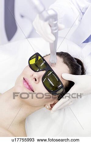 Stock Image - Beauty technician using laser treatment. This treatment is used to treat scars, wrinkles and stretch marks, but also for pigmentation removal.. Fotosearch
