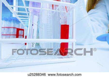 Biological research. View Large Photo Image Stock Photograph - Biological research.. Fotosearch