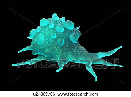 Stock Photograph - Bladder cancer cells, illustration.. Fotosearch