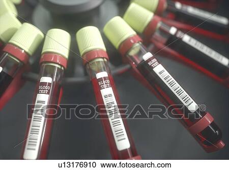 Stock Image - Blood samples in centrifuge, illustration.. Fotosearch