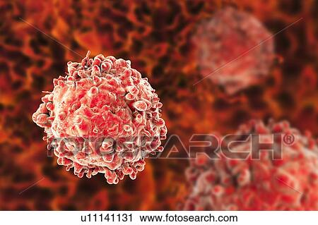 Stock Image - Computer illustration of a cancerous white blood cell in leukaemia.. Fotosearch