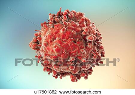 Stock Image - Computer illustration of a cancerous white blood cell in leukaemia.. Fotosearch