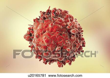 Computer illustration of a cancerous white blood cell in leukaemia. View Large Photo Image Stock Image - Computer illustration of a cancerous white blood cell in leukaemia.. Fotosearch