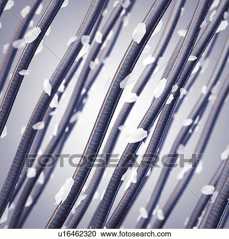 Stock Image - Dandruff, illustration.. Fotosearch