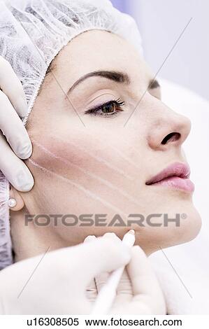 Dermatologist drawing marks on woman face for thread-lift, close-up. View Large Photo Image Stock Photography - Dermatologist drawing marks on woman face for thread-lift, close-up.. Fotosearch