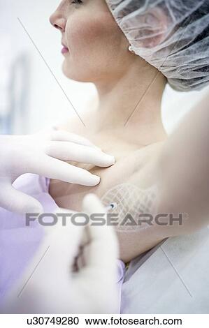 Stock Image - Dermatologist injecting botox in underarm to treat excessive sweating, close-up.. Fotosearch