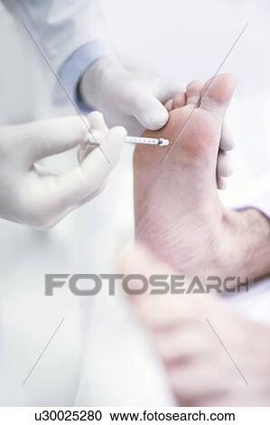 Stock Image - Dermatologist injecting botox into the sole of a foot to treat excessive sweating, close-up.. Fotosearch