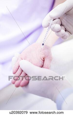Dermatologist injecting botox into the palm of the hand to treat excessive sweating, close-up. View Large Photo Image Stock Photo - Dermatologist injecting botox into the palm of the hand to treat excessive sweating, close-up.. Fotosearch