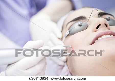 Picture - Dermatologist using carbon dioxide laser resurfacing machine on woman's face, close-up. This treatment is used on acne scars, wrinkles, skin pigmentation, warts, and spots.. Fotosearch