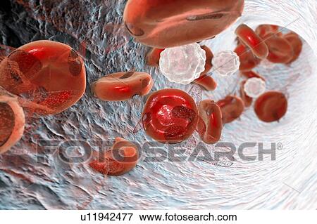 Stock Photo - Destruction of red blood cells, computer illustration. Conceptual image for anemia pathogenesis, diagnostics and treatment.. Fotosearch