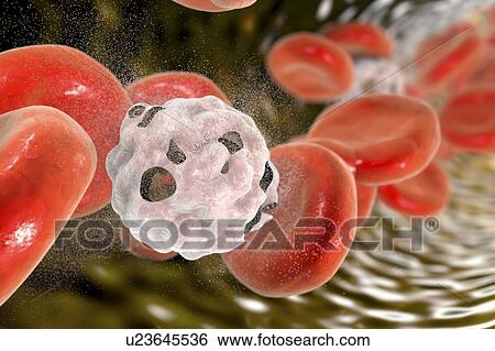 Stock Photograph - Destruction of white blood cell, illustration.. Fotosearch