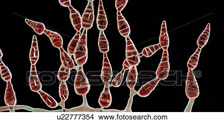 Filamentous allergenic fungus Alternaria alternata, computer illustration. Alternaria is a dematiaceous (phaeoid) fungus commonly isolated from plants, soil, food, and indoor building environment. They are causative agents of phaeohyphomycosis and... View Large Photo Image Picture - Filamentous allergenic fungus Alternaria alternata, computer illustration. Alternaria is a dematiaceous (phaeoid) fungus commonly isolated from plants, soil, food, and indoor building environment. They are causative agents of phaeohyphomycosis and.... Fotosearch