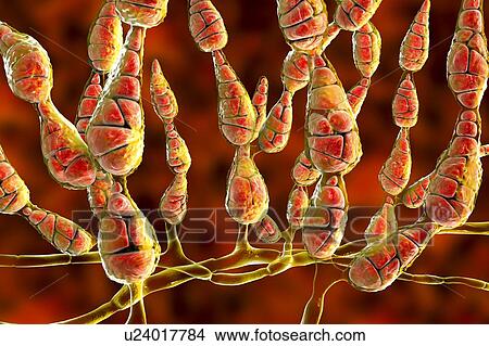 Picture - Filamentous allergenic fungus Alternaria alternata, computer illustration. Alternaria is a dematiaceous (phaeoid) fungus commonly isolated from plants, soil, food, and indoor building environment. They are causative agents of phaeohyphomycosis and.... Fotosearch