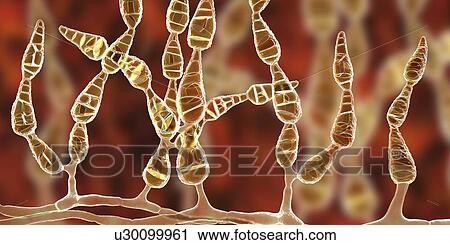 Stock Image - Filamentous allergenic fungus Alternaria alternata, computer illustration. Alternaria is a dematiaceous (phaeoid) fungus commonly isolated from plants, soil, food, and indoor building environment. They are causative agents of phaeohyphomycosis and.... Fotosearch