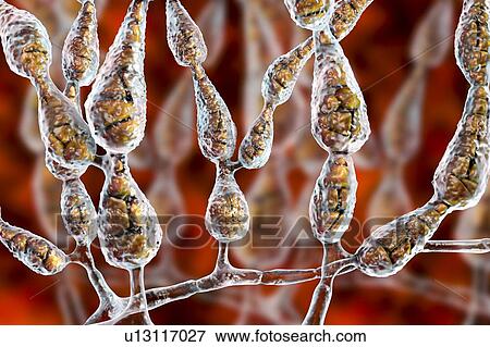 Filamentous allergenic fungus Alternaria alternata, computer illustration. Alternaria is a dematiaceous (phaeoid) fungus commonly isolated from plants, soil, food, and indoor building environment. They are causative agents of phaeohyphomycosis and... View Large Photo Image Stock Photo - Filamentous allergenic fungus Alternaria alternata, computer illustration. Alternaria is a dematiaceous (phaeoid) fungus commonly isolated from plants, soil, food, and indoor building environment. They are causative agents of phaeohyphomycosis and.... Fotosearch