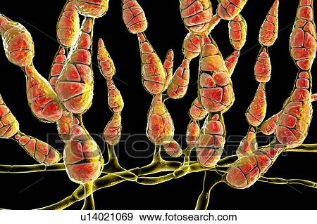 Stock Photo - Filamentous allergenic fungus Alternaria alternata, computer illustration. Alternaria is a dematiaceous (phaeoid) fungus commonly isolated from plants, soil, food, and indoor building environment. They are causative agents of phaeohyphomycosis and.... Fotosearch