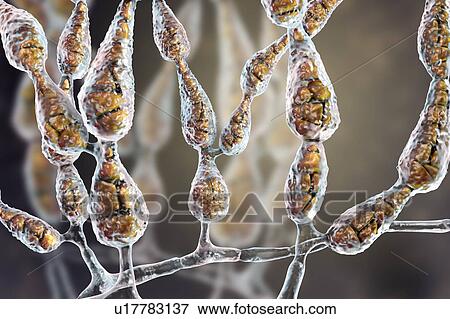 Stock Photo - Filamentous allergenic fungus Alternaria alternata, computer illustration. Alternaria is a dematiaceous (phaeoid) fungus commonly isolated from plants, soil, food, and indoor building environment. They are causative agents of phaeohyphomycosis and.... Fotosearch