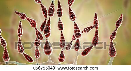 Stock Photo - Filamentous allergenic fungus Alternaria alternata, computer illustration. Alternaria is a dematiaceous (phaeoid) fungus commonly isolated from plants, soil, food, and indoor building environment. They are causative agents of phaeohyphomycosis and.... Fotosearch