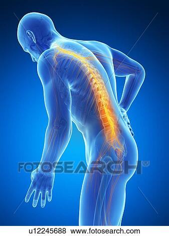 Human back pain, computer artwork. View Large Photo Image Stock Photo - Human back pain, computer artwork.. Fotosearch