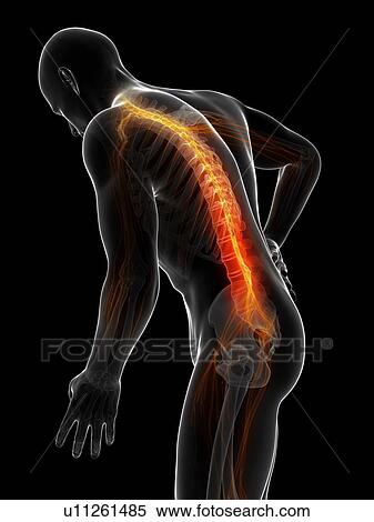 Human back pain, computer artwork. View Large Photo Image Stock Photography - Human back pain, computer artwork.. Fotosearch