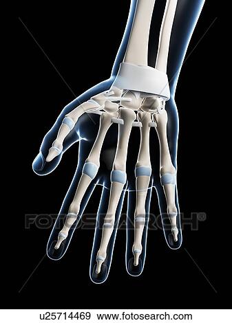 Stock Photo - Human hand bones, computer artwork.. Fotosearch