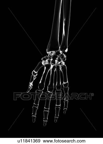 Stock Photo - Human hand bones, computer illustration.. Fotosearch