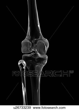 Human knee joint, computer illustration. View Large Photo Image Stock Photo - Human knee joint, computer illustration.. Fotosearch