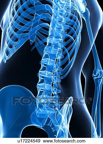 Stock Photo - Human lumbar spine, computer artwork.. Fotosearch