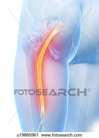 Human sciatic nerve, computer artwork. View Large Photo Image Stock Image - Human sciatic nerve, computer artwork.. Fotosearch