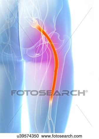 Stock Image - Human sciatic nerve, computer artwork.. Fotosearch