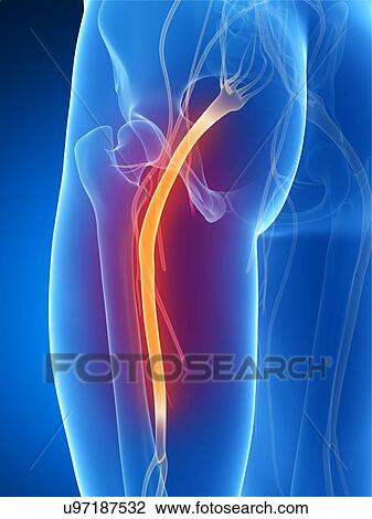 Stock Image - Human sciatic nerve, computer artwork.. Fotosearch