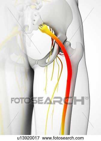 Stock Photo - Human sciatic nerve, computer artwork.. Fotosearch