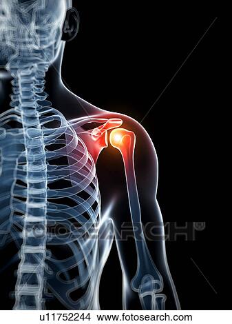 Picture - Human shoulder pain, computer artwork.. Fotosearch