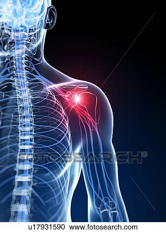 Stock Image - Human shoulder pain, computer artwork.. Fotosearch