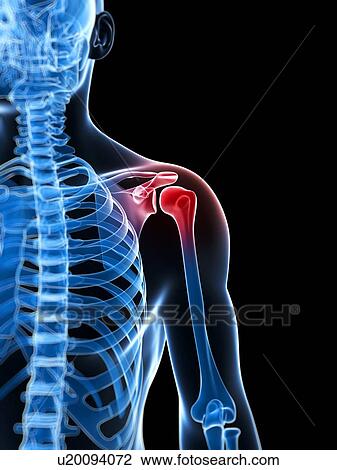 Stock Image - Human shoulder pain, computer artwork.. Fotosearch