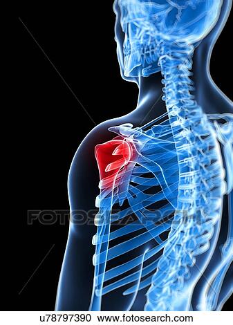 Human shoulder pain, computer artwork. View Large Photo Image Stock Image - Human shoulder pain, computer artwork.. Fotosearch