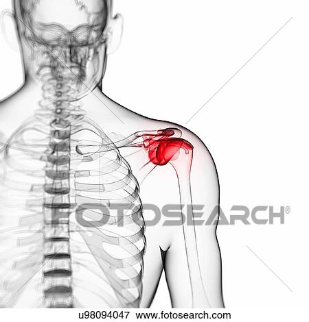 Stock Photo - Human shoulder pain, computer artwork.. Fotosearch