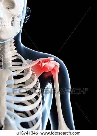 Stock Photography - Human shoulder pain, computer artwork.. Fotosearch