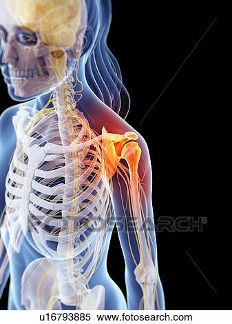 Stock Photography - Human shoulder pain, computer artwork.. Fotosearch