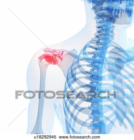 Stock Photography - Human shoulder pain, computer artwork.. Fotosearch