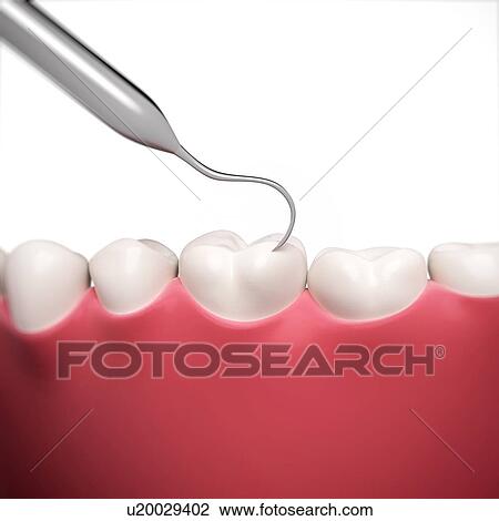 Stock Image - Human teeth being cleaned, computer artwork.. Fotosearch