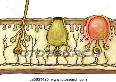 Stock Photography - Illustration of how an acne spot is formed. The sebaceous gland produces sebum which travels up the hair and exits via the pore (left). The sebum protects the skin and gives it its shiny appearance in the case of greasy skin. When sebum is produced in.... Fotosearch